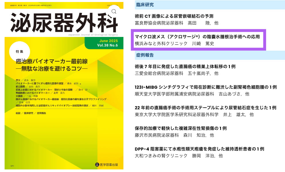 医学雑誌『泌尿器外科』に掲載された当院の陰嚢水腫手術成績の論文
